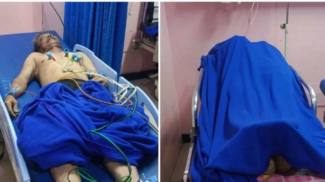 4 Pekerja Tewas Keracunan Gas di Basement TB Simatupang, Berawal dari Upaya Tolong Rekan